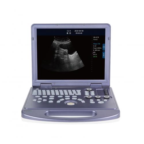 U1-360 PC Platform Full-Digital Black and White Ultrasound System