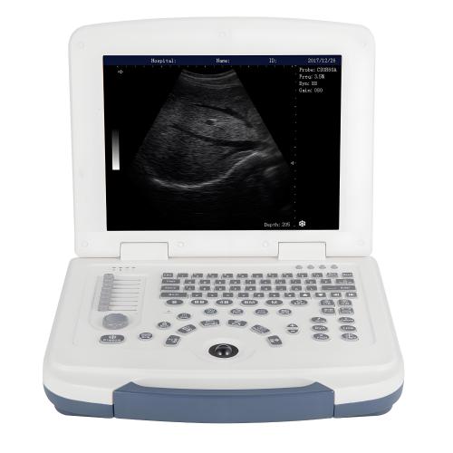 U1-580 Laptop Black And White Ultrasound System